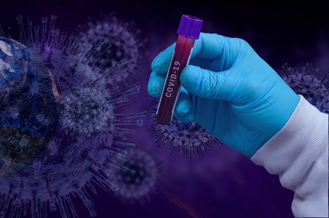 В Югре за сутки выявили 85 новых случаев коронавируса, число умерших достигло 772