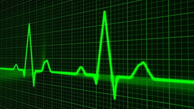 ​В Сургуте спасли 34-летнего мужчину с инфарктом