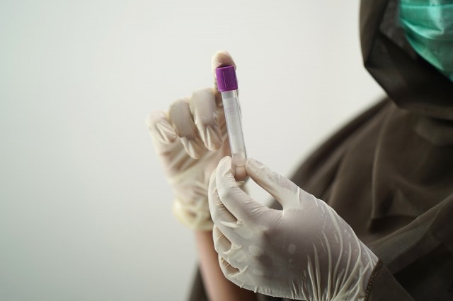 В ХМАО количество заразившихся «омикроном» достигло 13